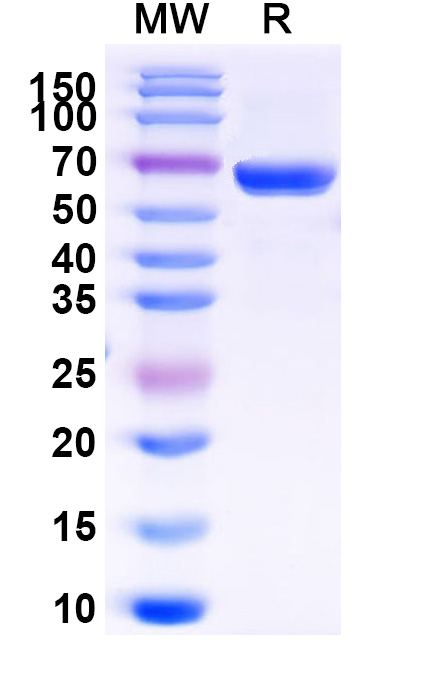 SDS-PAGE for Mouse EFNB1 Recombinant Protein, C-Fc