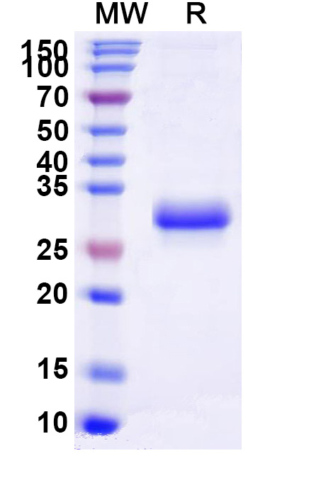 SDS-PAGE for Mouse EFNB3 Recombinant Protein, C-His