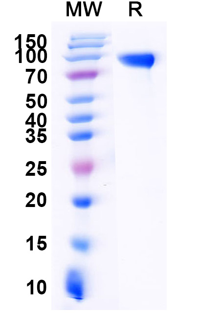 SDS-PAGE for Mouse EGFR/ERBB1/HER1 Recombinant Protein, C-His