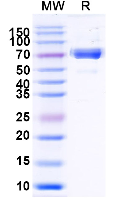 SDS-PAGE for Mouse ERBB3/HER3 Recombinant Protein, C-His