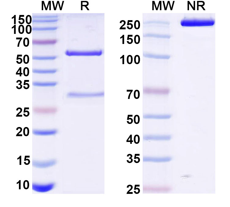 SDS-PAGE for Mouse IgG2b, kappa Isotype Control Antibody (27-35#)