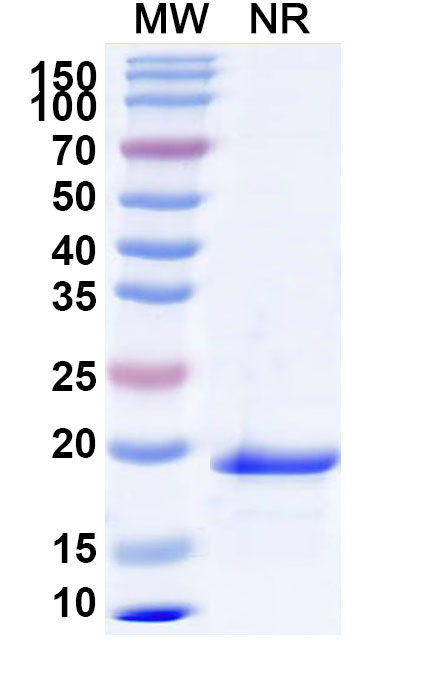 SDS-PAGE for Mouse IL24 Recombinant Protein, N-His