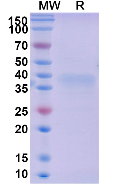 SDS-PAGE for Mouse LAYN recombinant protein