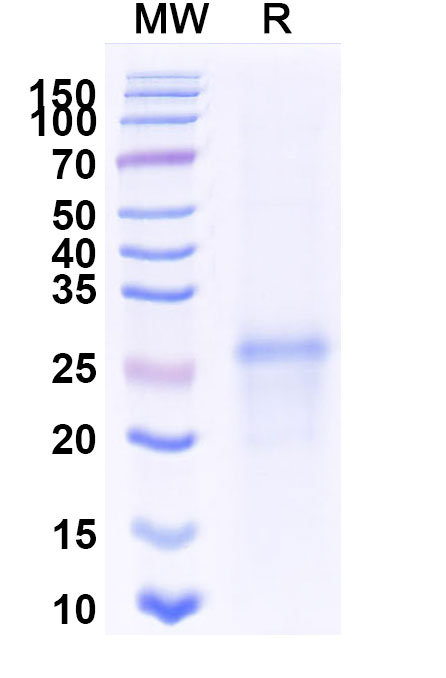 SDS-PAGE for Mouse SDC4 recombinant protein