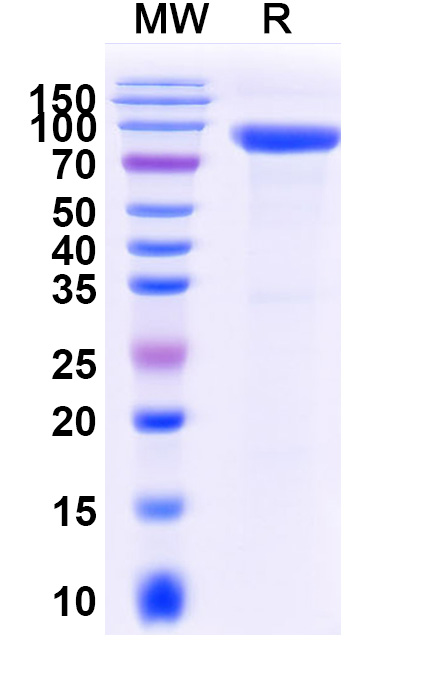 SDS-PAGE for Mouse SFRP5 Recombinant Protein, C-Fc