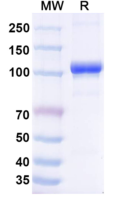 SDS-PAGE for Mouse TF/Serotransferrin Recombinant Protein, C-Fc