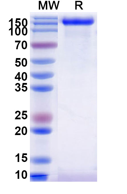 SDS-PAGE for MUC16 recombinant protein