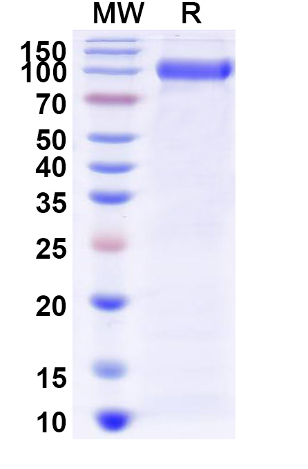 SDS-PAGE for Myozyme;Alglucosidase Alfa Biosimilar - Anti-GAA;Aglucosidase alfa mAb - Research Grade