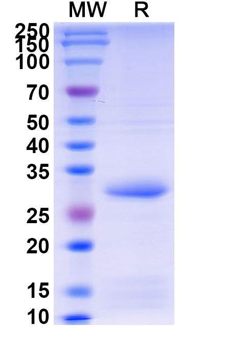 SDS-PAGE for N-acyl homoserine lactonase(aiiA)