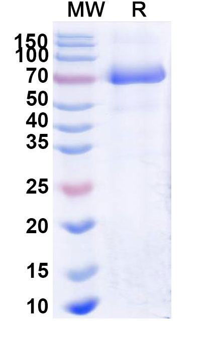 SDS-PAGE for Naglazyme;Galsulfase Biosimilar - Anti-ARSB mAb - Research Grade