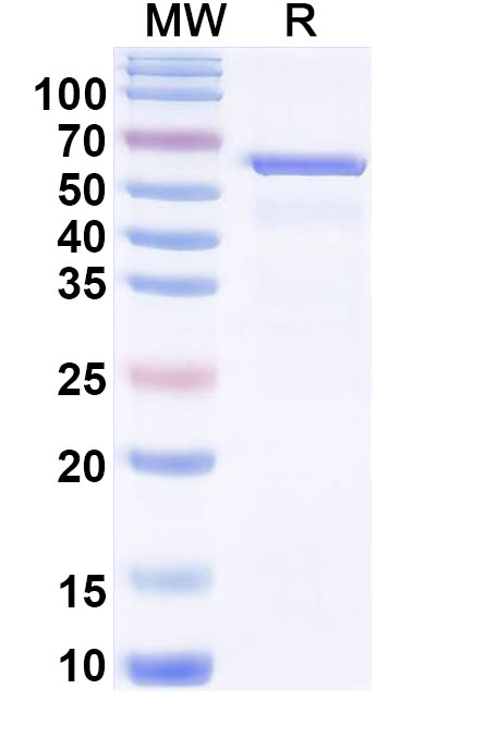 SDS-PAGE for NR3C1, N-His, recombinant protein
