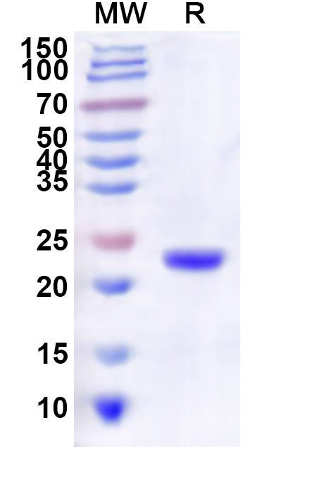 SDS-PAGE for Oropouche virus/OROV Glycoprotein G2, N-His