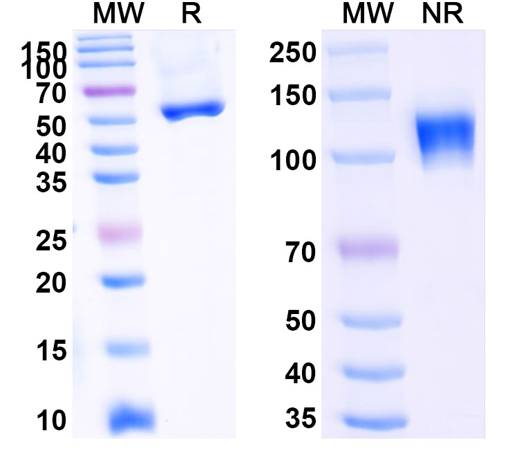 SDS-PAGE for Research Grade Ozekibart