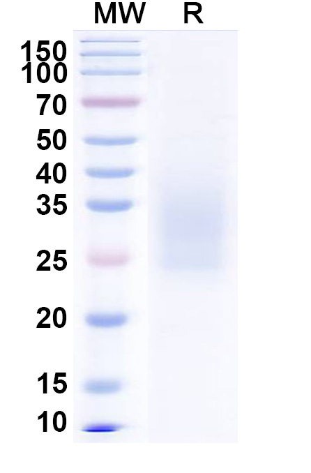 SDS-PAGE for Porcine epidemic diarrhea virus (strain CV777) (PEDV) PEDV Spike glycoprotein (RBD)  recombinant protein