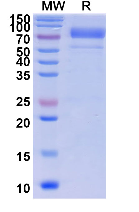 SDS-PAGE for Prothrombin(F2)