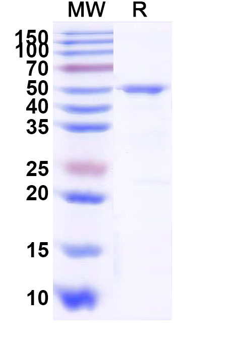 SDS-PAGE for PSMC3, N-His, recombinant protein