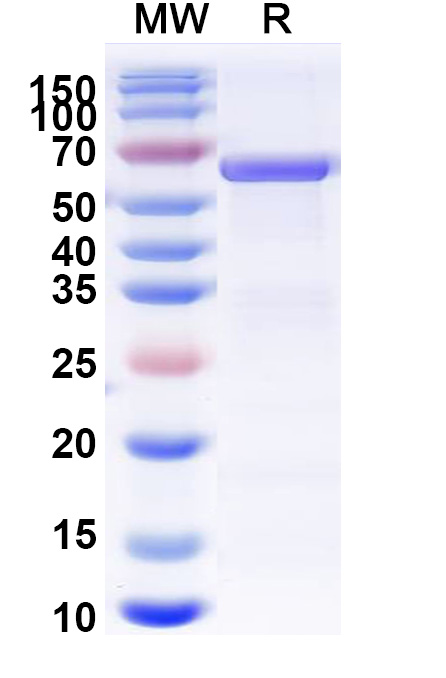 SDS-PAGE for Pyruvate kinase PKM(PKM)
