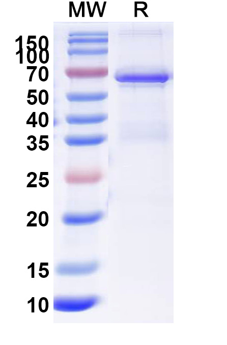 SDS-PAGE for RAC-alpha serine-threonine-protein kinase(AKT1)