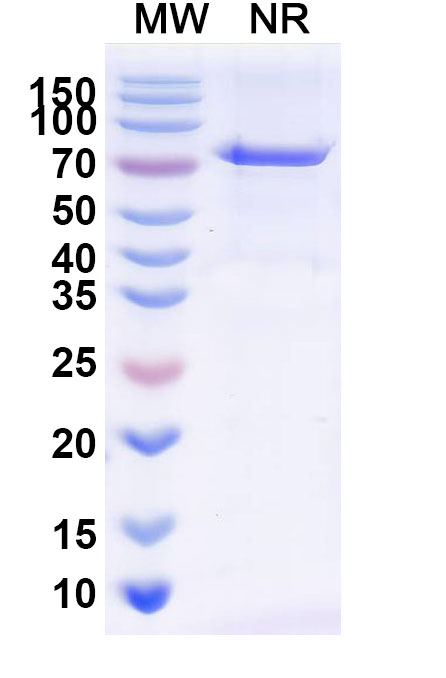 SDS-PAGE for Radretumab Biosimilar - Anti-EDB mAb - Research Grade