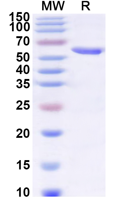SDS-PAGE for Recombinant AAV3B VP1/Capsid protein, N-His