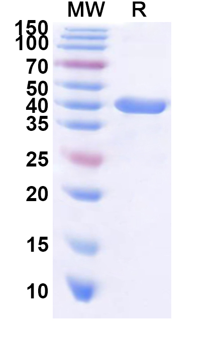 SDS-PAGE for Recombinant Arabidopsis MPK6 Protein, N-His