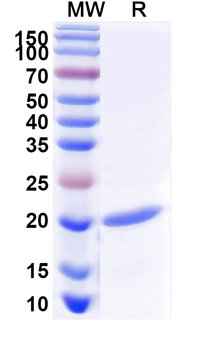 SDS-PAGE for Recombinant ASFV B438L/p49 Protein, N-His