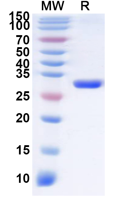 SDS-PAGE for Recombinant ASFV D117L Protein, N-His-KSI
