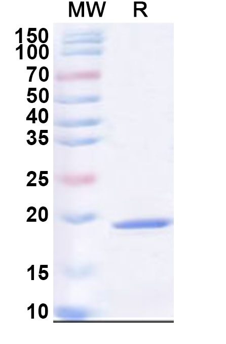 SDS-PAGE for Recombinant ASFV I177L Protein, N-His