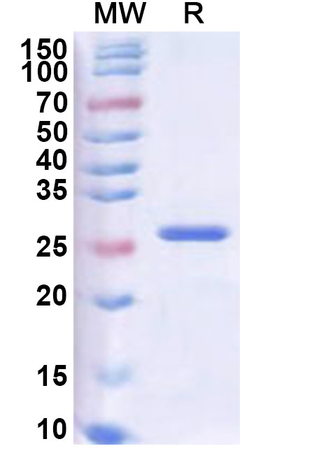 SDS-PAGE for Recombinant ASFV MGF_360-4L Protein, N-His-SUMO