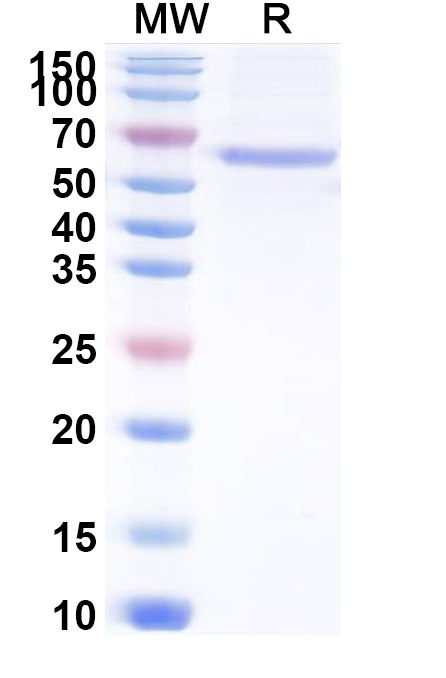 SDS-PAGE for Recombinant ASFV P30/CP204L Protein, N-Fc
