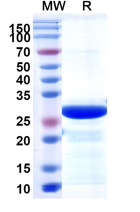 SDS-PAGE for Recombinant ASFV p72/B646L Protein, N-His