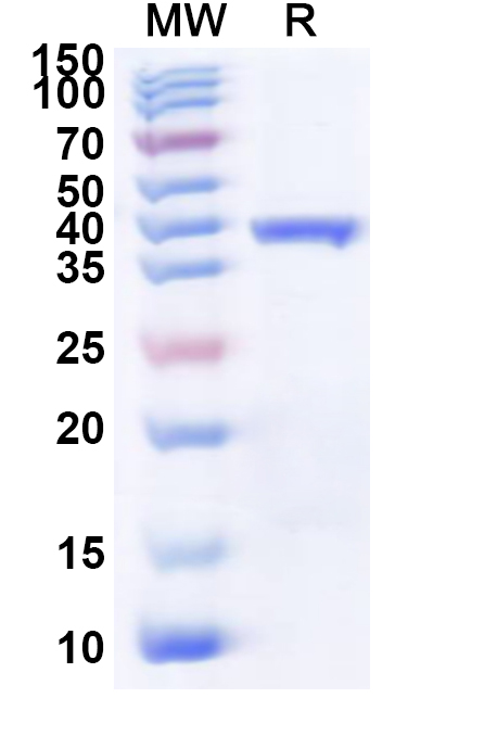 SDS-PAGE for Recombinant Avian HEV Capsid Protein, N-His