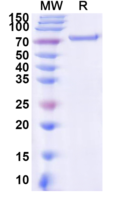 SDS-PAGE for Recombinant Avian myelocytomatosis virus MYC Protein, N-His-KSI