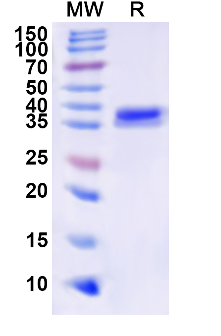 SDS-PAGE for Recombinant Bacillus cereus gajA Protein, N-His