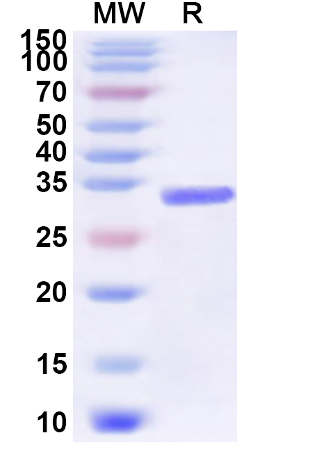 SDS-PAGE for Recombinant Bordetella pertussis dnt3 Protein, N-His