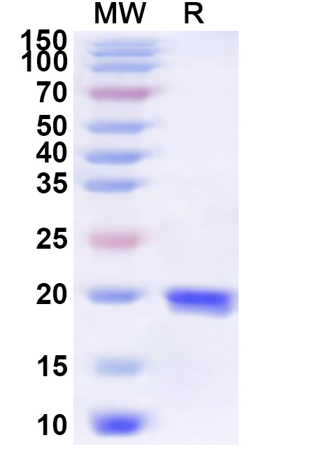 SDS-PAGE for Recombinant Bordetella pertussis pagL Protein, N-His