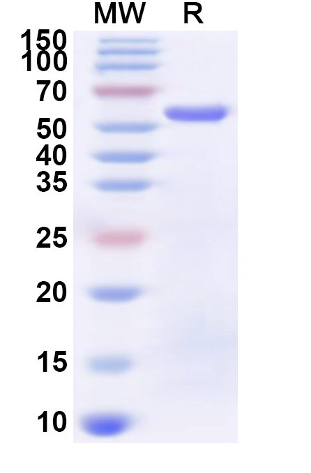 SDS-PAGE for Recombinant Bordetella pertussis prn/P.94 Protein, N-His