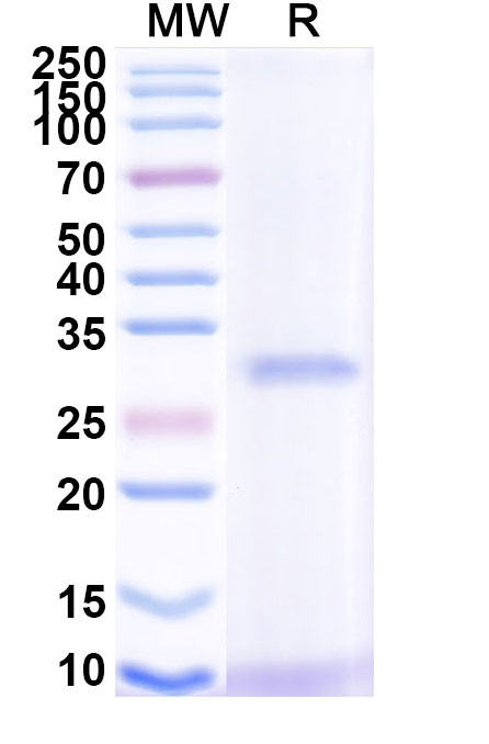 SDS-PAGE for Recombinant Bordetella pertussis ptxA/PTXS1 Protein, N-His