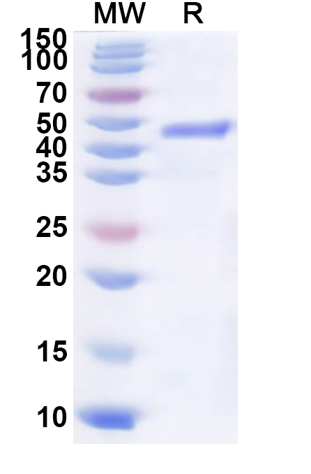 SDS-PAGE for Recombinant BRSV Fusion Glycoprotein, N-His
