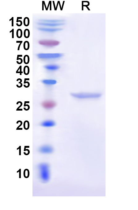 SDS-PAGE for Recombinant Cat CD274/PD-L1/B7-H1 Protein, N-His