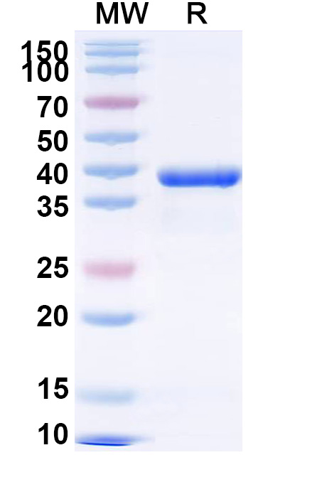 SDS-PAGE for Recombinant Cat Fel d 1A/CH1 Protein, N-GST & C-His
