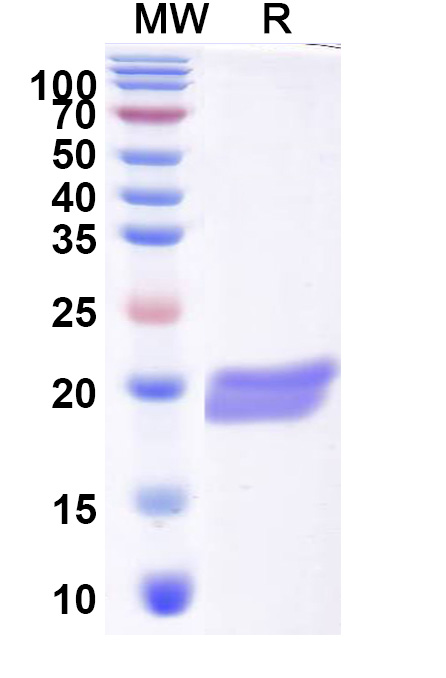 SDS-PAGE for Recombinant CHIKV Capsid Protein, N-His