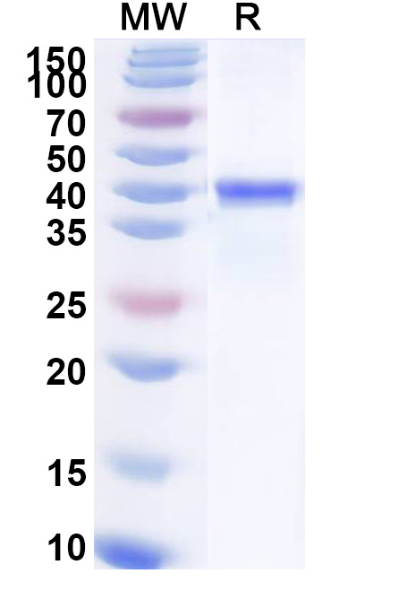SDS-PAGE for Recombinant CHIKV NPS1 Protein, N-His