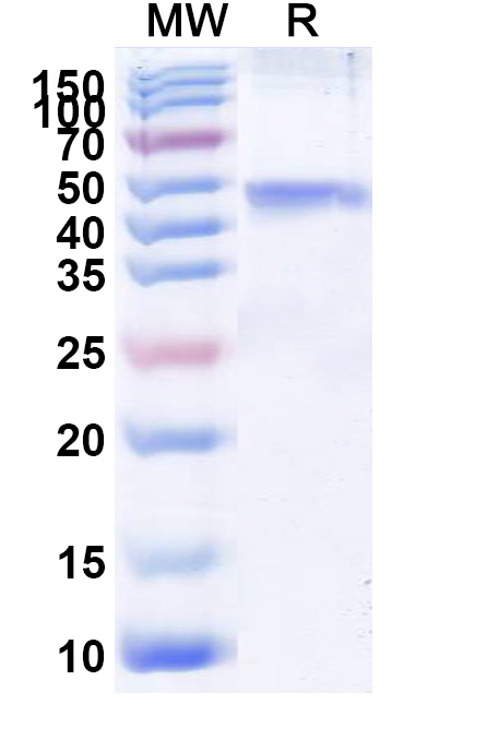 SDS-PAGE for Recombinant CHIKV Spike glycoprotein E1 Protein, N-His