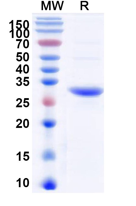 SDS-PAGE for Recombinant Clostridioides difficile Toxin B/tcdB, N-His