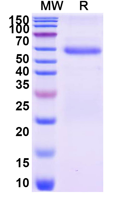 SDS-PAGE for Recombinant Clostridium perfringens plc/Phospholipase C/Alpha-toxin, C-His