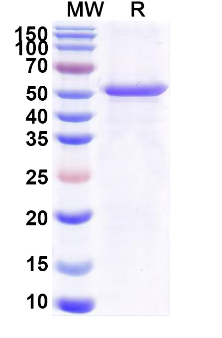SDS-PAGE for Recombinant Common timothy PHLPIV/Phl p 4 Protein, N-His