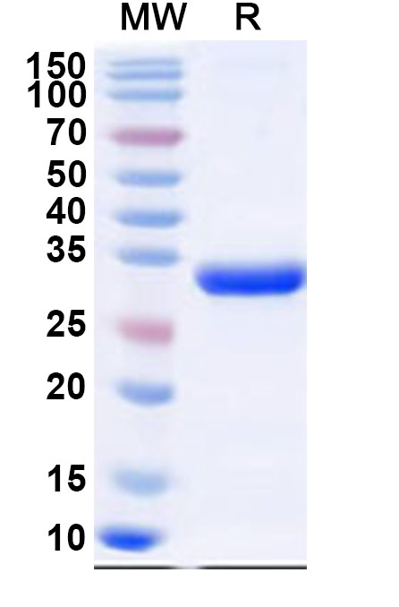 SDS-PAGE for Recombinant CPV-2 NS1 Protein, N-His