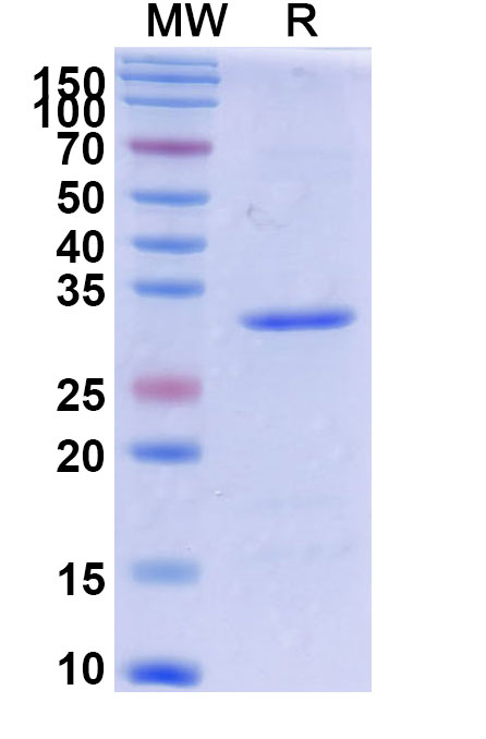 SDS-PAGE for Recombinant Cutibacterium acnes PPA2105/Triacylglycerol lipase Protein, N-MAT