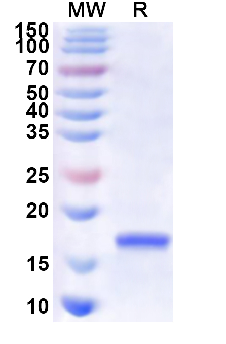 SDS-PAGE for Recombinant CVA6 P2A/Protease 2A Protein, N-His